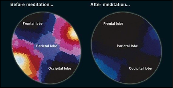 Your brain when you meditate