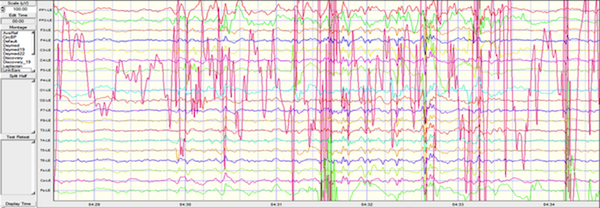 A look at our brainwaves!